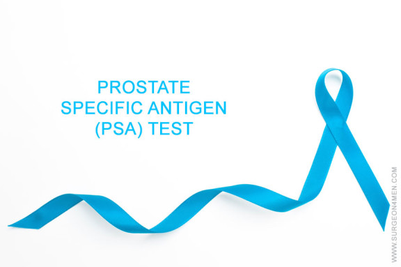 Early Prostate Cancer Detection