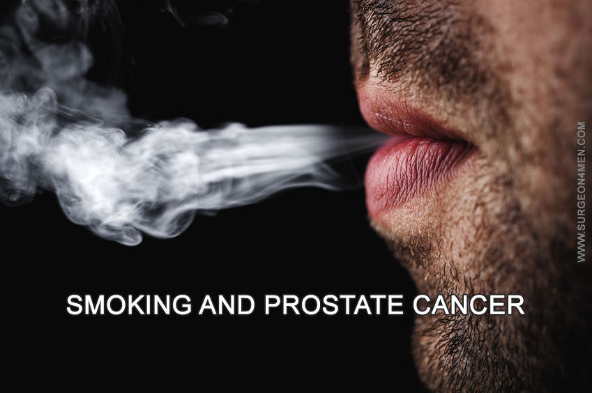 Smoking and Prostate Cancer Image