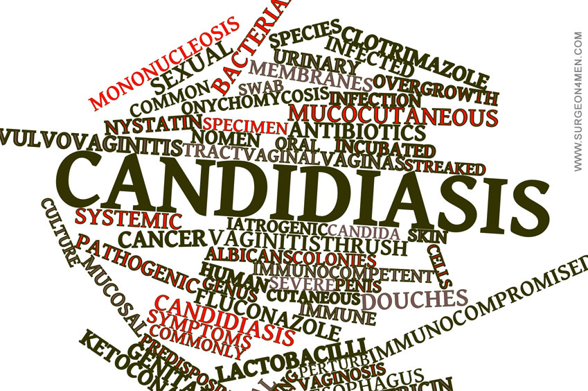 Candidiasis Image