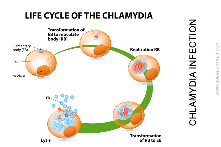 Chlamydia Infection Image