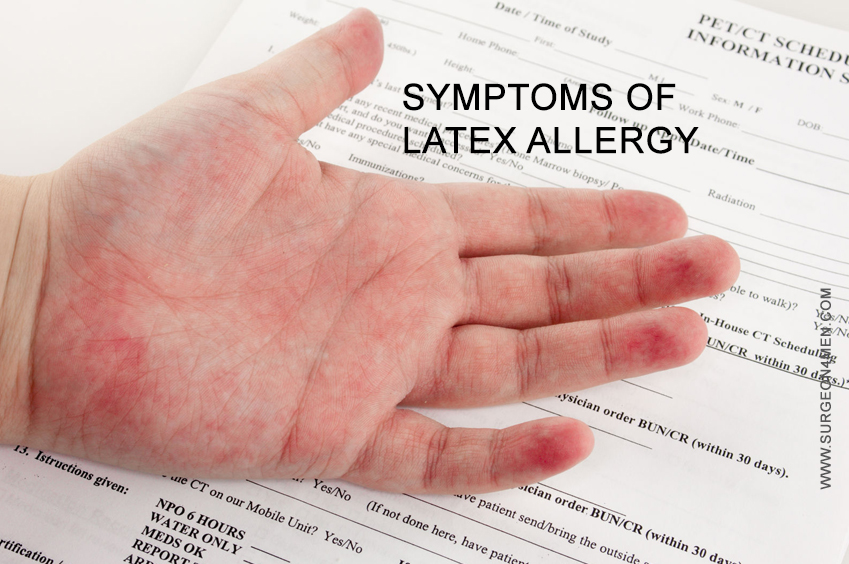 Latex Allergie Kondome Symptome Frau www.surgeonformen.com