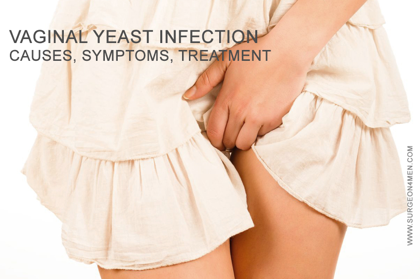 Vaginal Yeast Infection: Causes, Symptoms, Treatment image