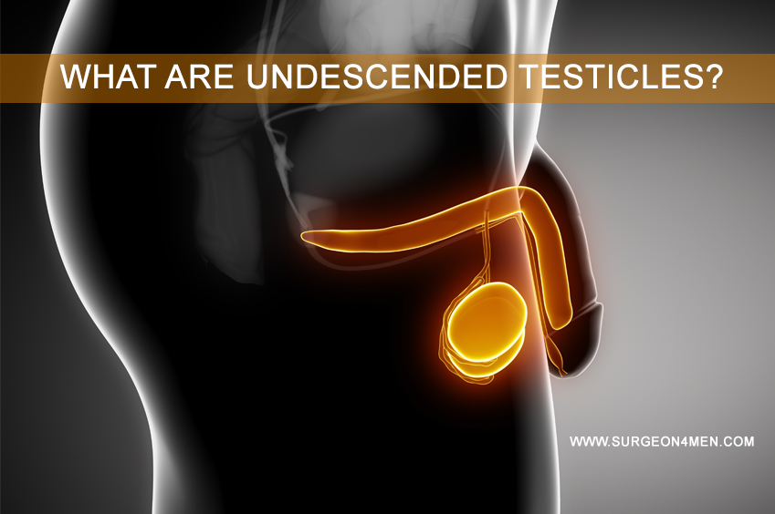 What are Undescended Testicles image