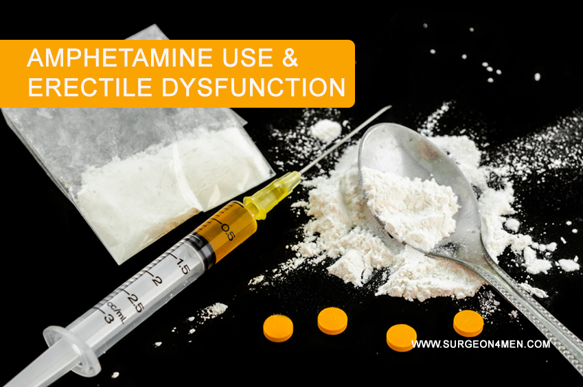 Amphetamine Use & Erectile Dysfunction. 