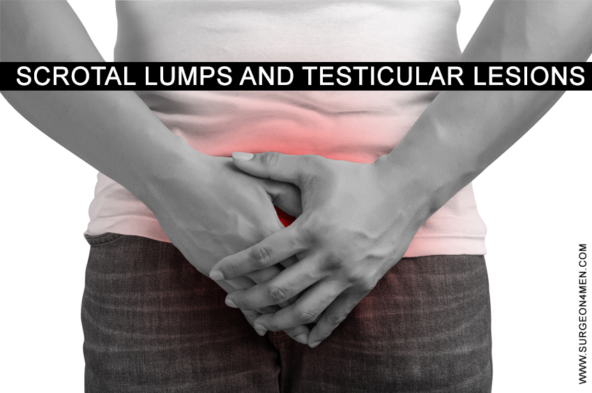 Scrotal Lumps And Testicular Lesions image