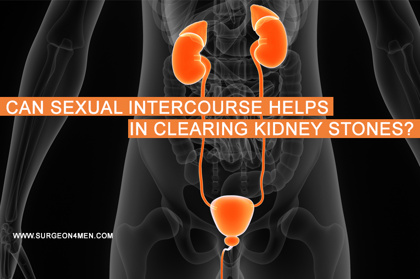 Can Sexual Intercourse Helps In Clearing Kidney Stones? image