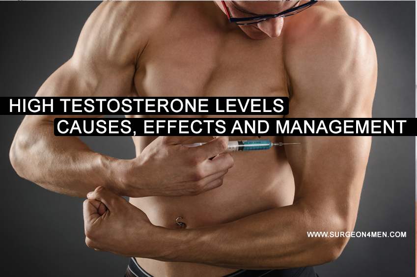 High Testosterone Levels | Causes, Effects And Management image