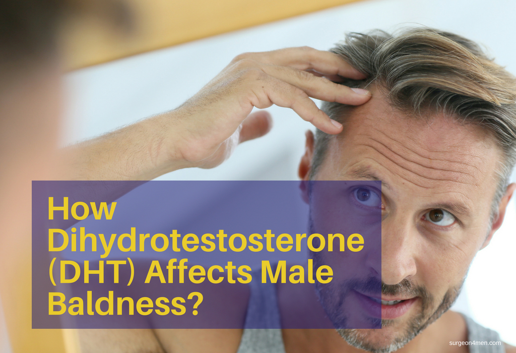 How Dihydrotestosterone (DHT) Affects Male Baldness?