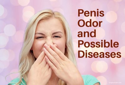 Penis Odor and Possible Diseases