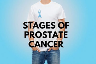 Stages Of Prostate Cancer