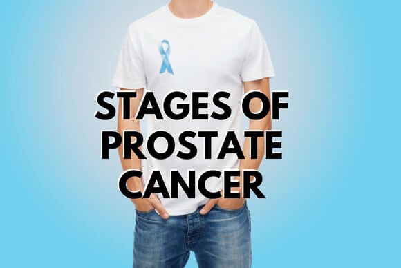 Stages Of Prostate Cancer