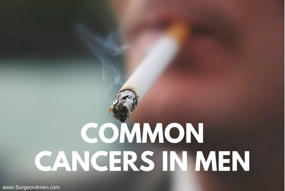 Common Cancers in Men