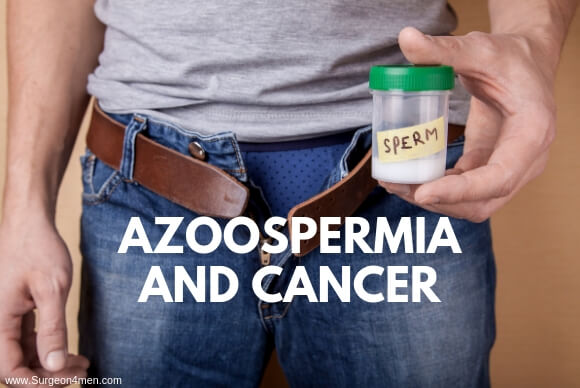 Azoospermia and Cancer