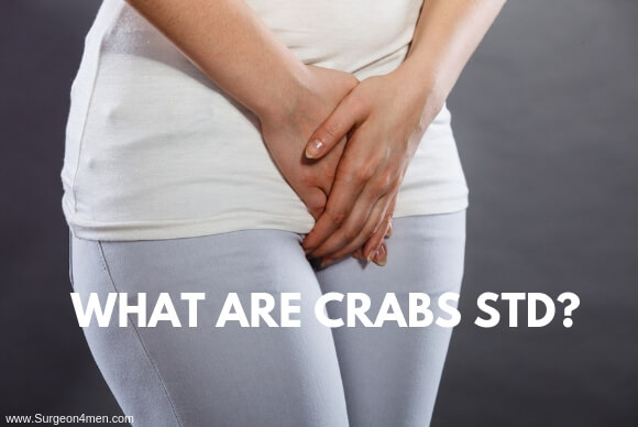 What are Crabs STD?